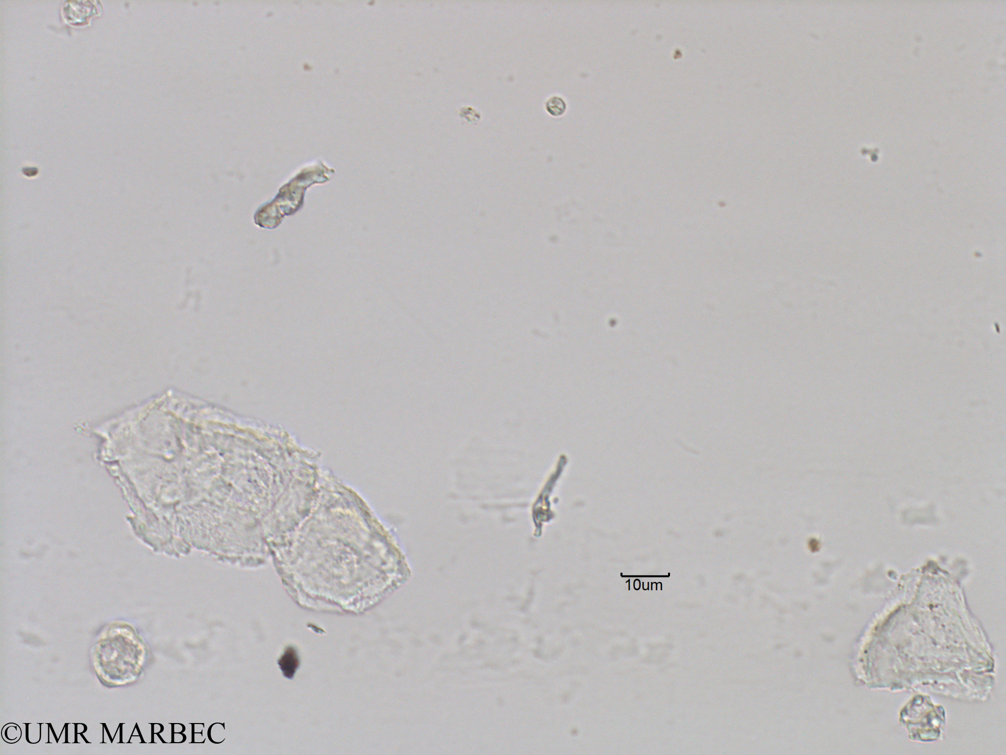 phyto/Bizerte/bizerte_bay/RISCO November 2015/Scrippsiella spp (Baie_T5-C2-3 scripsiella-7).tif(copy).jpg